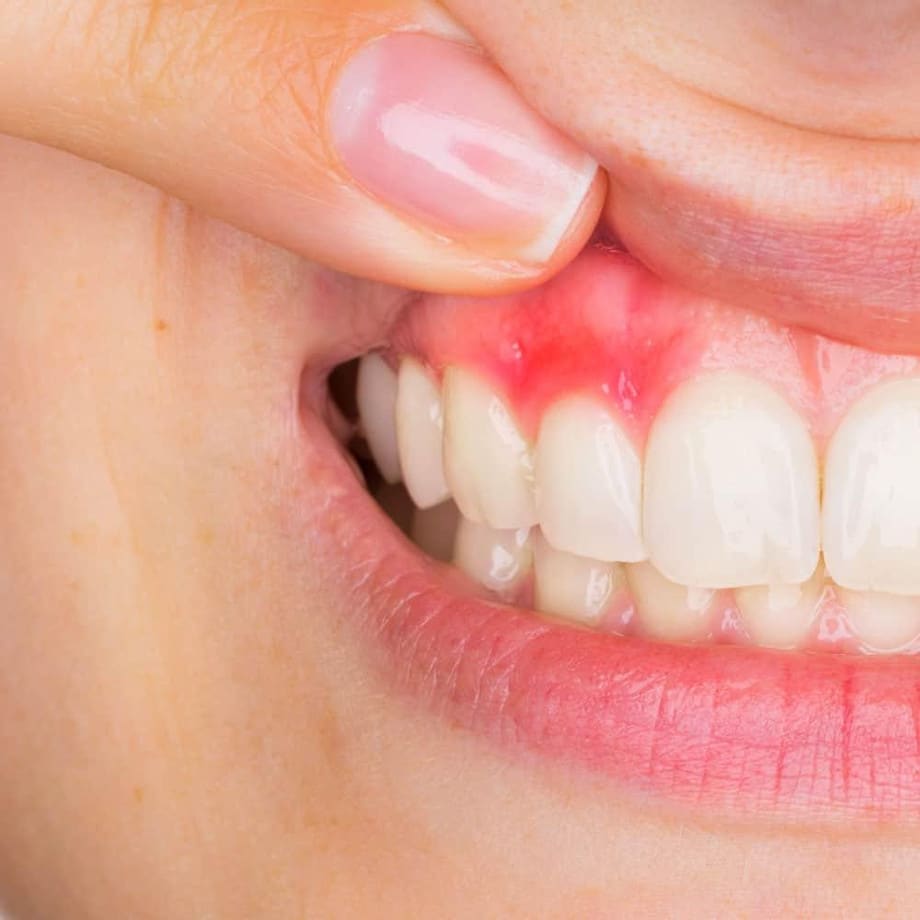 Can Urgent Care Treat Tooth Infection